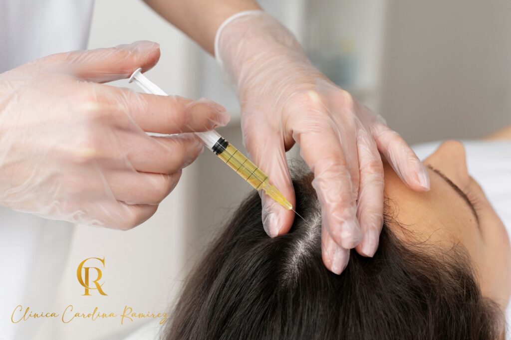 mesoterapia capilar para un cabello más fuerte